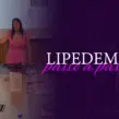 LIPEDEMA – PASSO A PASSO